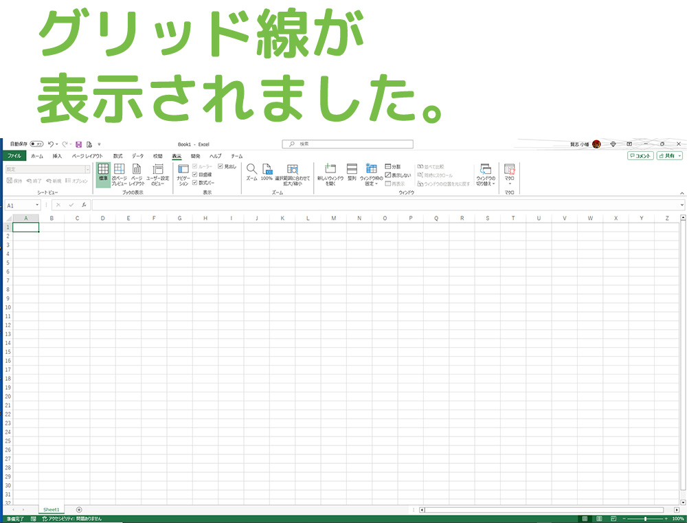 高度なトラブルシューティングと代替手法